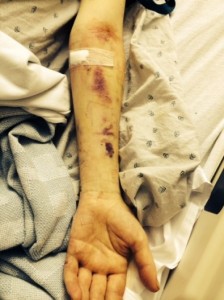 el-vocalista-de-sum-41-hospitalizado-por-fallas-en-rion