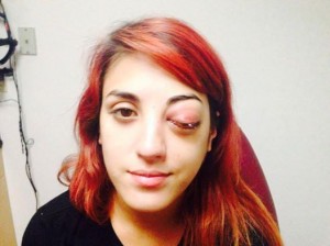 bajista-de-eyes-set-to-kill-sale-del-hospital